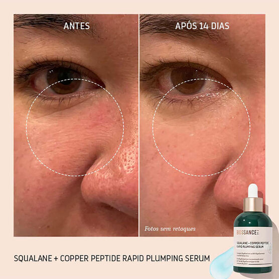 serum preenchedor com peptideos e esqualano